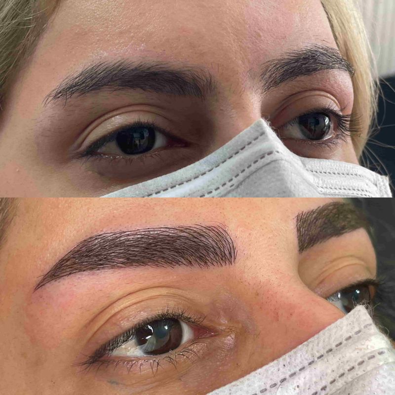 میکروبلیدینگ